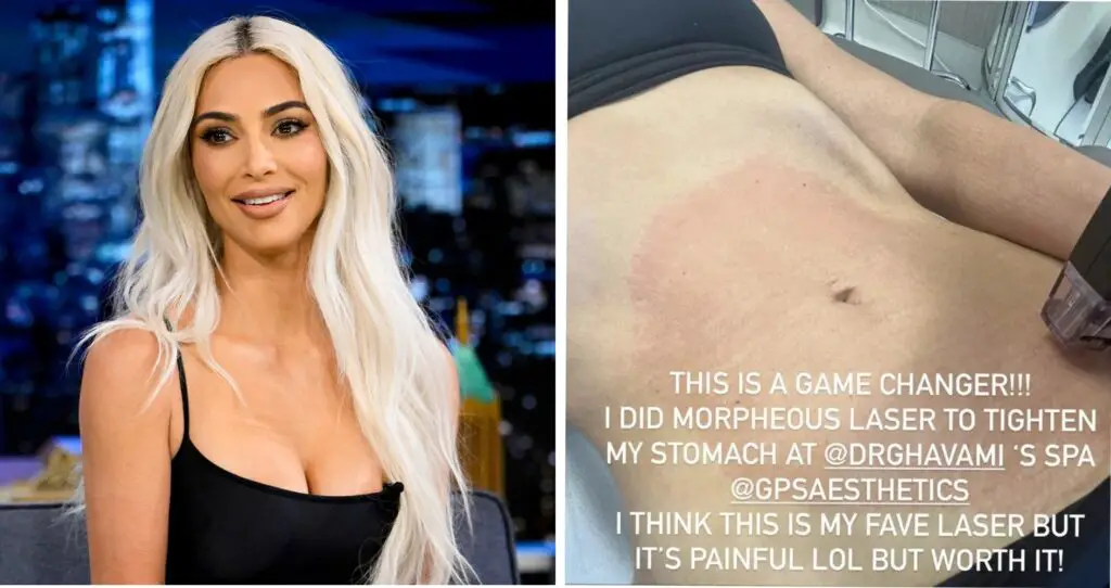 Kim Kardashian Reveals She Had Painful Stomach Tightening Procedure